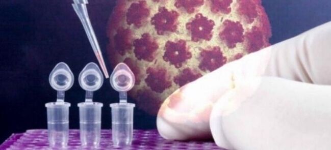 Digene testi ile HPV teşhisi