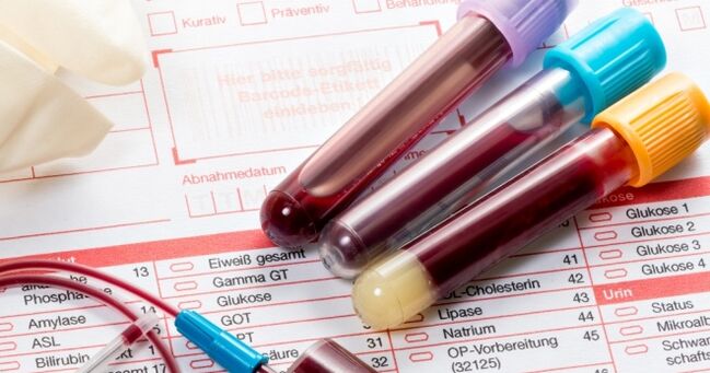 İnsan papilloma virüsü için kan testi