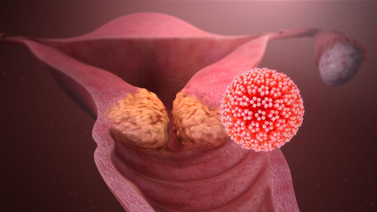 vücuttaki insan papilloma virüsü
